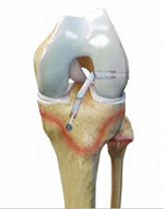 2023 HSS Insider_Reconstruction device_193px